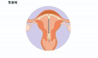 子宫移位有什么症状 检查说是子宫移位了,请问一下子宫移位怎么办什么叫子宫移位